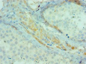 BIRC2 Antibody