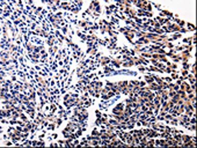 BIRC5 Antibody