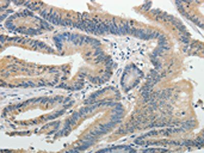 BIRC5 Antibody