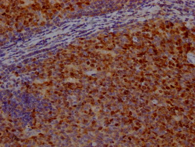 BIRC5 Recombinant Monoclonal Antibody