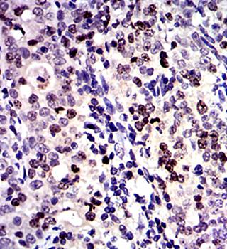 BIRC5 Antibody