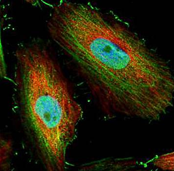 BIVM antibody