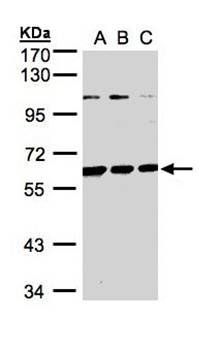 BIVM antibody