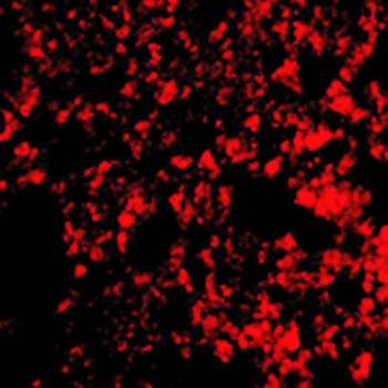 Blimp-1 Rabbit Polyclonal Antibody