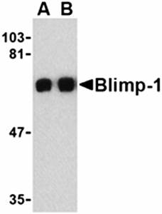 Blimp-1 Rabbit Polyclonal Antibody