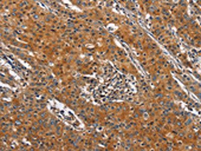 BLK Antibody