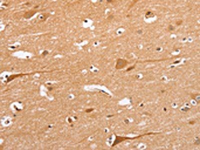 BLNK Antibody