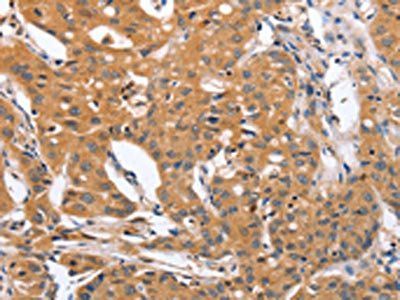 BLNK Antibody