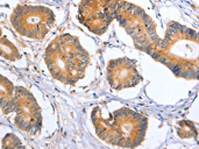 BLNK Antibody