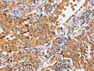 BLNK Antibody
