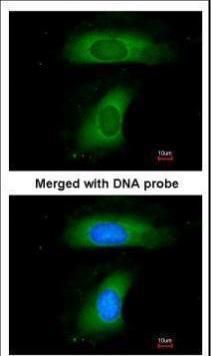 BLNK Rabbit Polyclonal Antibody