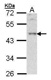 BLNK Rabbit Polyclonal Antibody