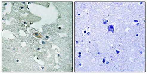 BLNK (Phospho-Tyr84) Antibody