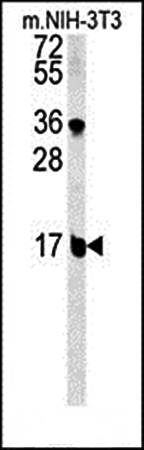BLOC1S2 antibody