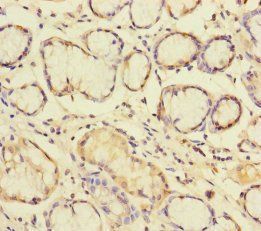 BLOC1S6 Antibody