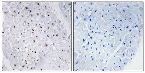 Bloom Syndrome (Phospho-Thr99) Antibody