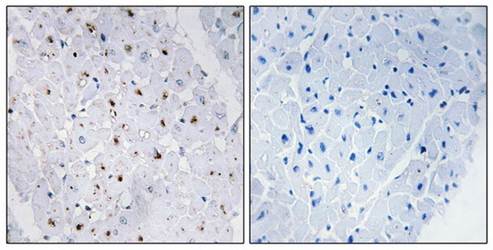 Bloom Syndrome (phospho-Thr99) antibody