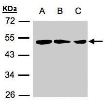 RARRES3 antibody