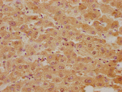 BLVRB Antibody