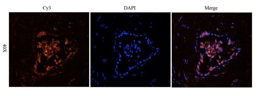 BMI1 antibody