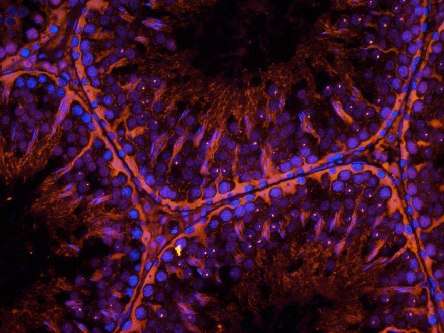 BMI1 antibody