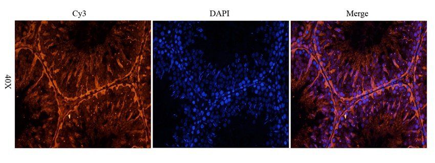 BMI1 antibody