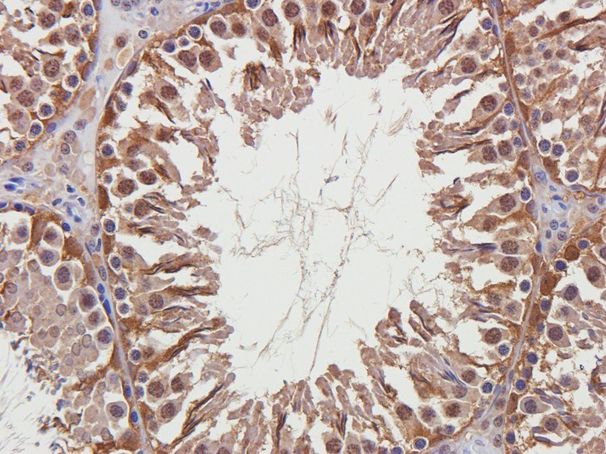 BMI1 antibody