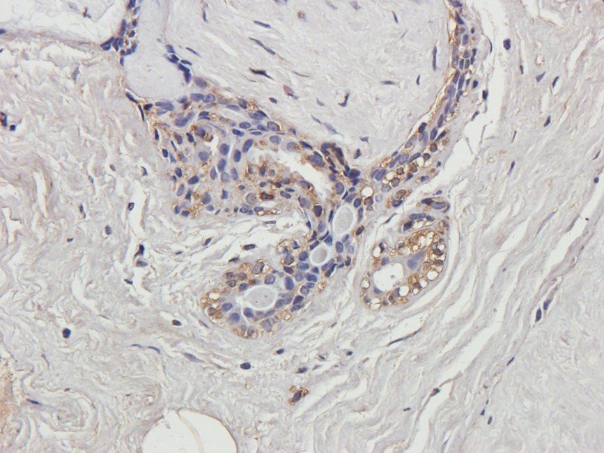 BMI1 antibody