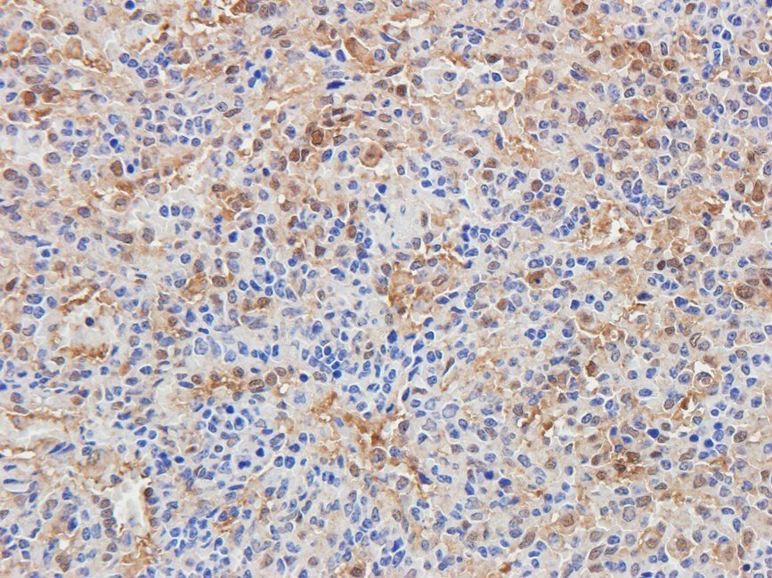 BMI1 antibody