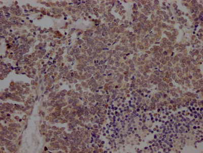 BMI1 Antibody