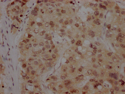 BMI1 Antibody