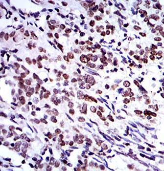 BMI1 Antibody