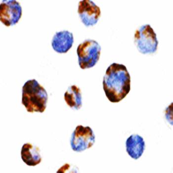 BMI Antibody