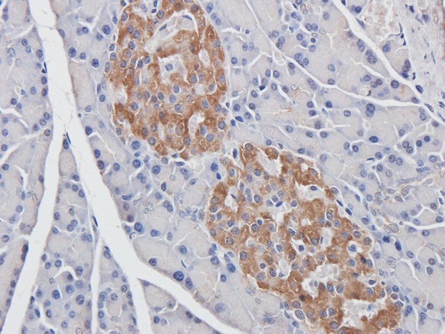 BMP11 antibody