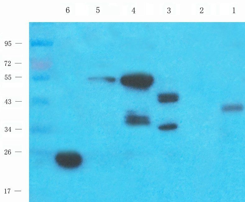 BMP11 antibody