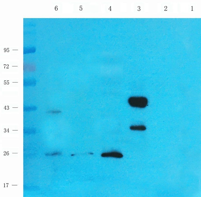 BMP11 antibody