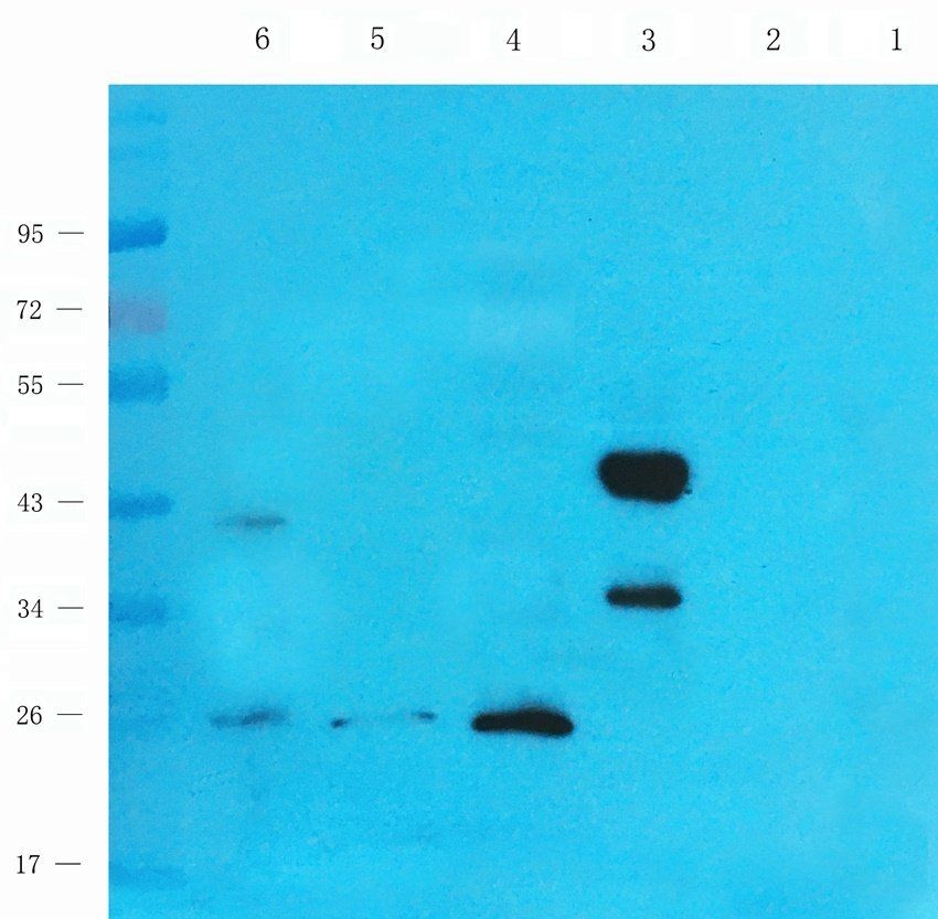 BMP11 antibody