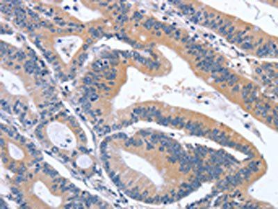 GDF11 Antibody