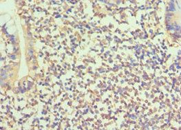 BMP15 antibody