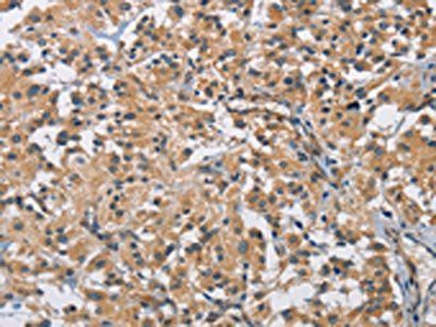 BMP15 antibody