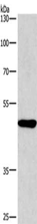 BMP15 antibody