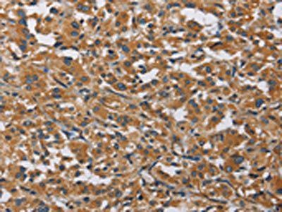 BMP15 Antibody