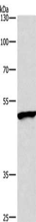 BMP15 antibody