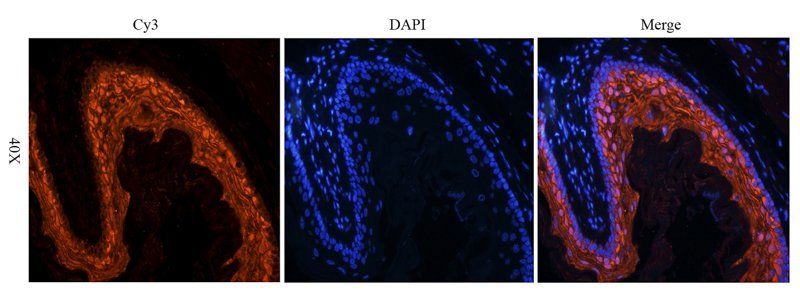 BMP2 antibody