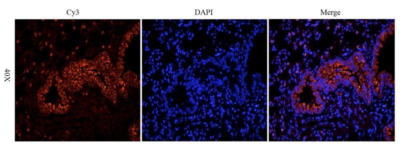 BMP2 antibody