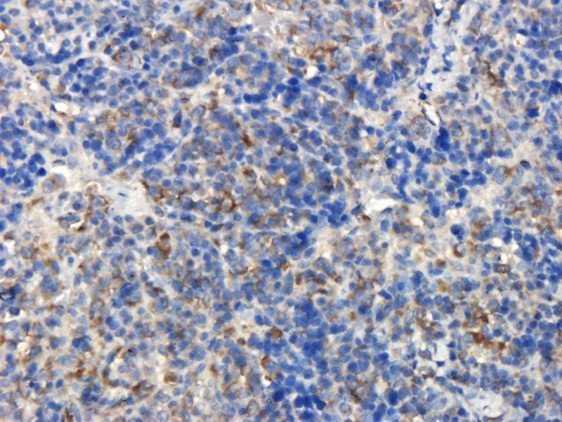 BMP2 antibody