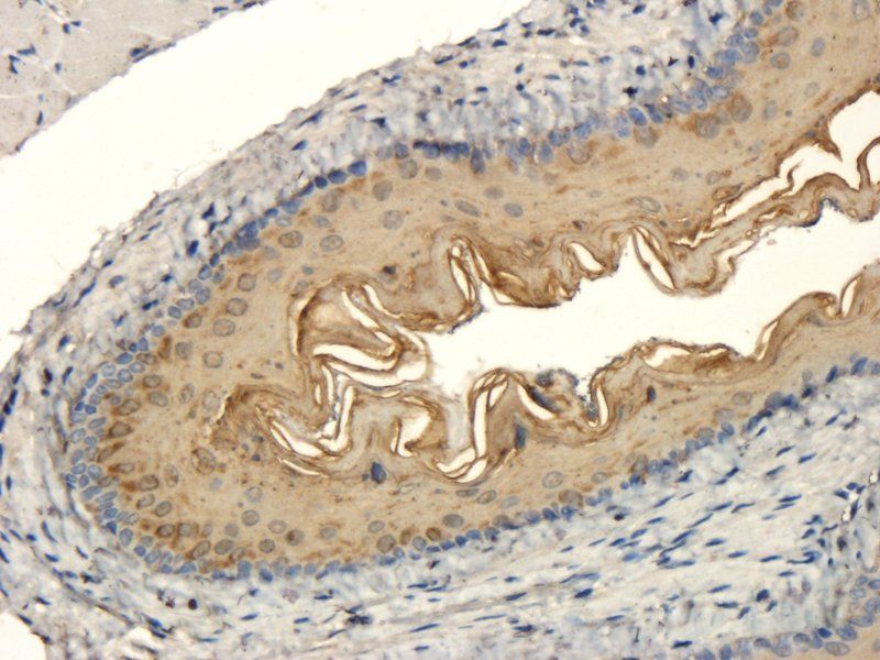 BMP2 antibody