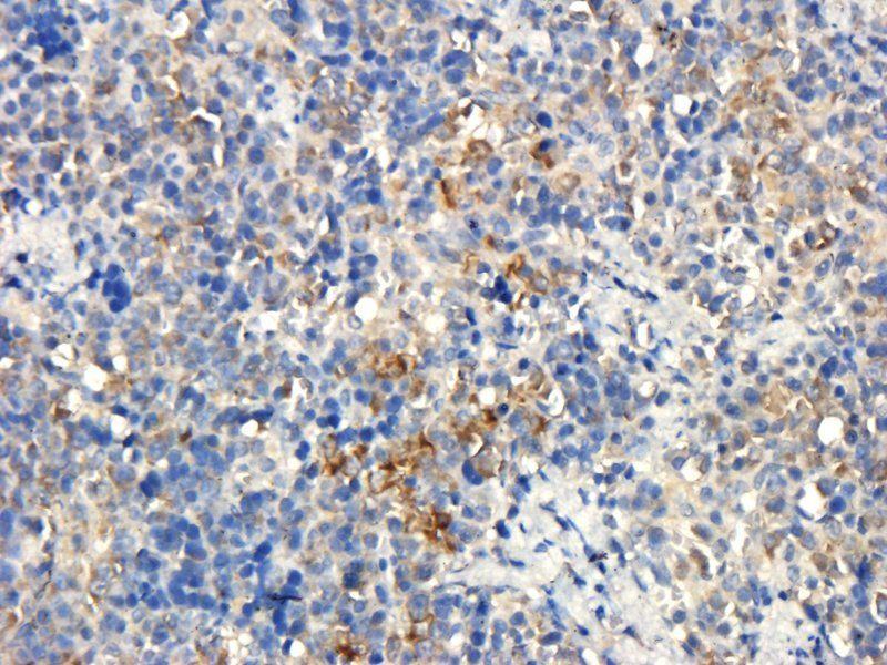 BMP2 antibody