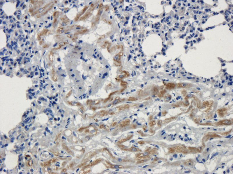 BMP2 antibody