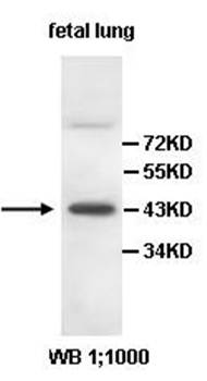 BMP2 Rabbit Polyclonal Antibody